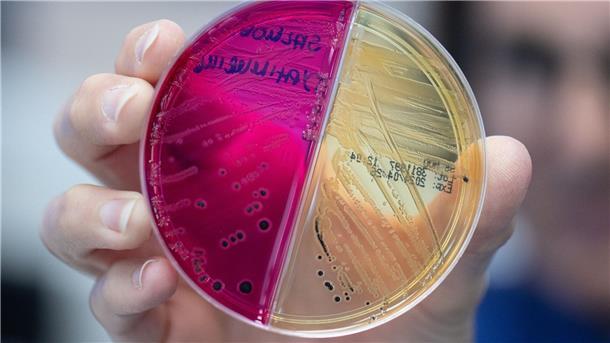 Detektivarbeit am Darm-Mikrobiom: Was Stuhlproben verraten Auf unterschiedlich eingefärbten Nährböden wachsen Keime heran, die zur genauen Analyse eingesandt wurden.
