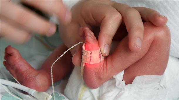 UN fordern mehr Einsatz zur Vermeidung von Frühgeburten Bei überlebenden Frühchen kann die Gesundheit ein Leben lang beeinträchtigt sein.