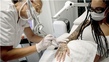 Bald entfernen nur noch Ärzte unliebsame Tattoos