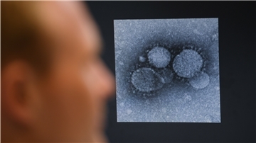 Das Coronavirus beschäftigt auch hessische Wissenschaftler. Die Virologen der Uni Marburg sind an der Entwicklung eines Impfstoffs gegen den Lungen-Erreger beteiligt.