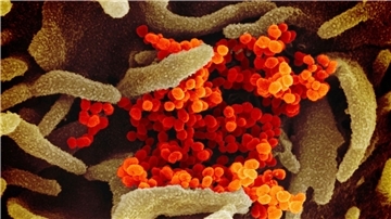 Das Coronavirus (SARS-CoV-2, orange) tritt aus der Oberfläche von im Labor kultivierten Zellen (grau) aus. Die Probe wurde von einem Patienten in den USA isoliert.