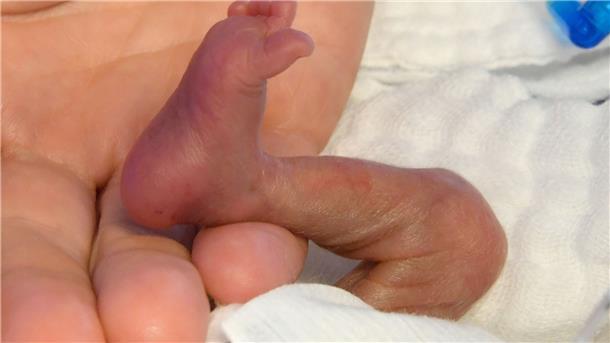 WHO: Frühchen brauchen Hautkontakt - noch vor dem Brutkasten Der direkte Hautkontakt von Frühchen und Mutter bzw. Betreuungsperson noch vor dem Brutkasten, kann einen positiven Einfluss auf die Entwicklung der Kinder haben.