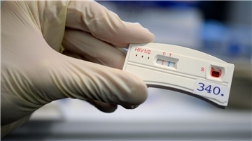 Der Teststreifen an einem HIV-Schnelltest verfärbt sich bei der Berliner Aids-Hilfe nach der Anwendung mit dem Blut einer Testperson.