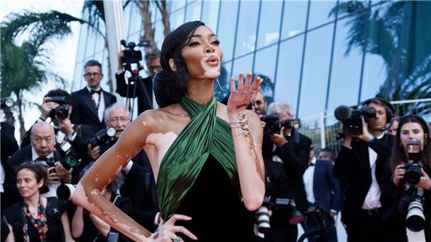 Leuchtend gelb auf rotem Teppich: Heidi Klum in Cannes Die Modeldichte ist in Cannes besonders hoch: Auch Winnie Harlow ist dabei.