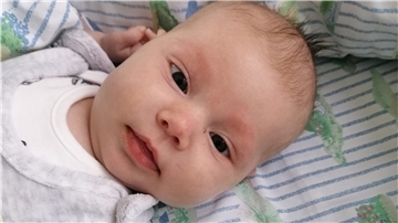 Die Therapie mit einem Antikörper-Medikament soll die 13-wöchige Amalia auf das Prozedere einer Knochenmarktransplantation vorbereiten.