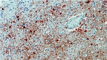 Die undatierte Aufnahme zeigt einen Anitkörpernachweis zum Borna-Virus im Gewebe.