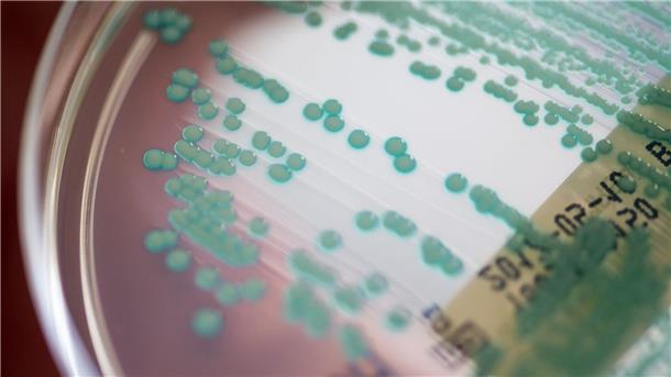 Datenanalyse: Antibiotika-Krise droht schlimmer zu werden Die Zahl der Todesfälle, bei denen multiresistente Keime eine Rolle spielen, könnte von 4,71 Millionen auf 8,22 Millionen steigen. (Archivbild)