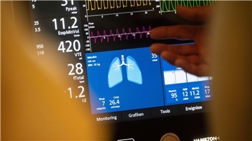 Künstliche Beatmung im Ernstfall? Diese und andere medizinische Maßnahmen können in der Patientenverfügung geregelt werden.