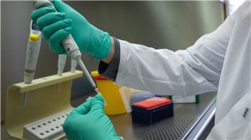 Ein Forscher zeigt, wie ein PCR-Test für die Analyse auf Mutationen des Coronavirus vorbereitet wird.