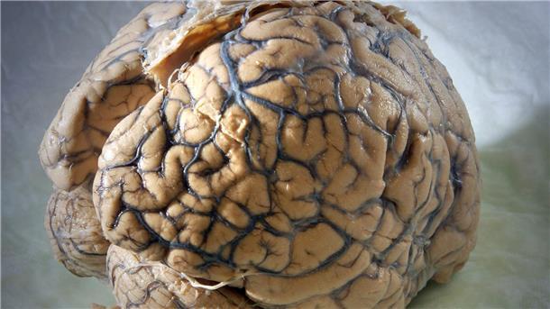 Gehirnatlas: Mensch hat über 3000 verschiedene Hirnzelltypen Ein Gehirn des Menschen in einem Labor der Klinik für Neurologie am Universitätsklinikum Jena.