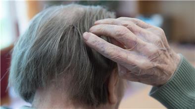 Ein neuartiges Antikörper-Medikament verlangsamt einer Studie zufolge das Fortschreiten von Alzheimer.