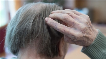 Ein neuartiges Antikörper-Medikament verlangsamt einer Studie zufolge das Fortschreiten von Alzheimer.