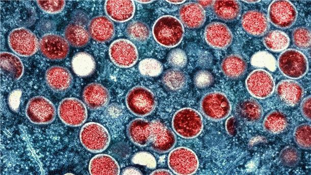 Eine eingefärbte Mikroskopaufnahme von mpox-Partikeln (rot) in einer infizierten Zelle (blau), die im Labor kultiviert wurde.