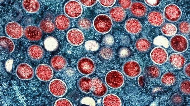 Affenpocken-Ausbruch bleibt Gesundheitsnotstand Eine eingefärbte Mikroskopaufnahme von Mpox-Partikeln (rot) in einer infizierten Zelle (blau), die im Labor kultiviert wurde.