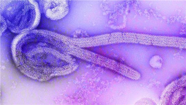 Behörden bemühen sich um Eindämmung von Marburg-Ausbrüchen Eine elektronenmikroskopische Aufnahme des Marburgvirus.