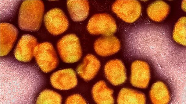 WHO hebt Gesundheitsnotstand wegen Affenpocken auf Eine kolorierte ektronenmikroskopische Aufnahme von Partikeln des Affenpockenvirus (Gold), kultiviert und gereinigt aus einer Zellkultur.