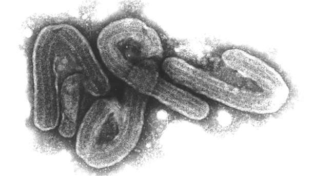 Ruanda findet Ursprung des Marburg-Ausbruchs Elektronenmikroskopische Aufnahme des Marburg-Virus. Das Marburg-Virus gehört zu den gefährlichsten bekannten Krankheitserregern.