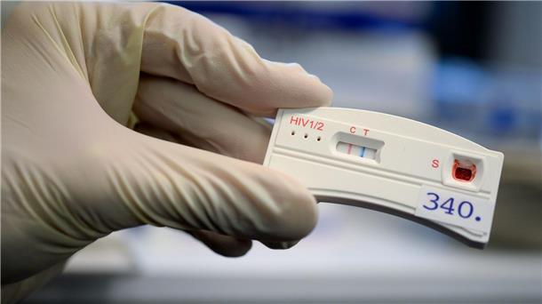 Aids-Konferenz in München - UN-Ziele auf der Kippe? HIV-Schnelltests helfen beim erkennen der Infektion. (Archivbild)