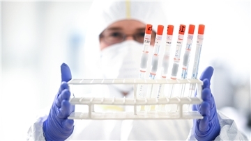 In Deutschland gibt es mittlerweile mehr als 500 bestätigte Coronavirus-Fälle.