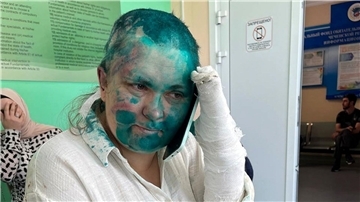 Investigativreporterin Jelena Milaschina wurde nach der Attacke in einem Krankenhaus behandelt.