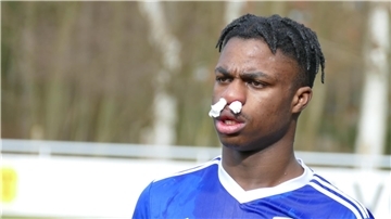 JFV Bremerhaven-Spieler Issac Omoike hat sich an der Nase verletzt.