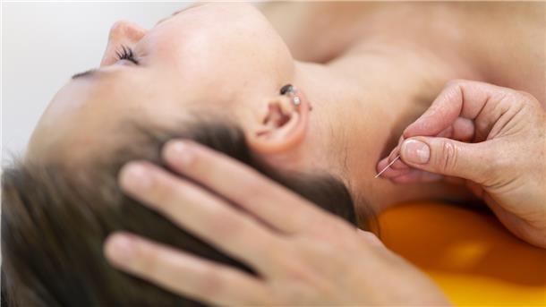 Kopfschmerzen lassen sich mit der Akupunktur, eine der fünf Säulen der Traditionellen Chinesischen Medizin, bekämpfen. Dabei werden kleine Nadeln am Köper oder Ohr angebracht. An spezifischen Stellen eingesetzt können sie einen regulierenden Einfluss auf die Funktion der Organe bewirken.