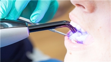 Laut KZBV-Vorstandschef Hendges gehen bei fachgerechtem Einsatz von Dentalamalgam keine Gesundheitsgefahren aus.