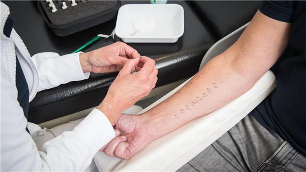 Ein Arzt für am Arm eines Patienten einen Pricktest durch. 