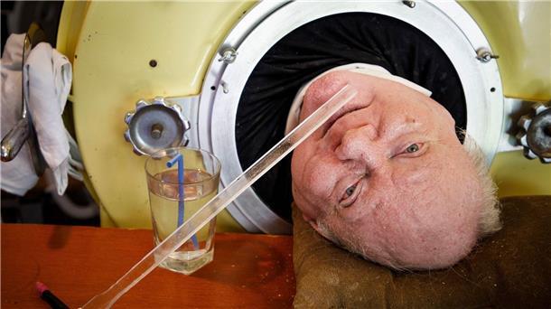 Paul Alexander ist im Alter von 78 Jahren gestorben.