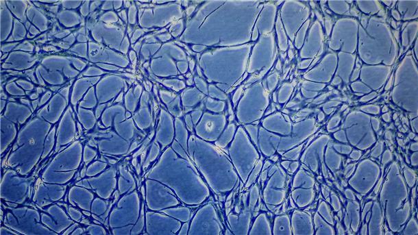 Proben kultivierter Fischzellen sind auf einem Monitor eines Mikroskops zu sehen. (Archivbild)