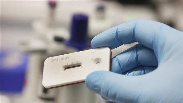 So oder ähnlich sehen die Corona-Schnelltests aus. Zwei Streifen geben einen Hinweis auf eine Infektion mit dem Corona-Virus. Es geht relativ schnell und ohne Labor, doch der logistische Aufwand für die Pflegeheime ist groß.