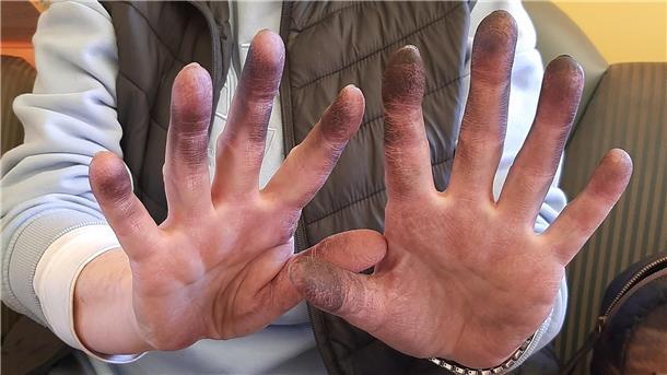 Eine Frau hält ihre schwarzen Hände in die Kamera. So sahen die Hände einer Teilnehmerin der Aktion „Sauberhafte Küste" aus, die auf dem Deich in Höhe Midgard Müll gesammelt hatte.