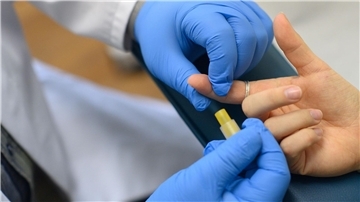 Weltweit leben rund 39 Millionen Menschen mit HIV-Infektionen. (Archivbild)
