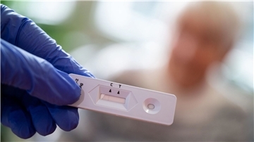 Wenn der Schnelltest positiv ist, dann folgt ein sogenannter PCR-Test.
